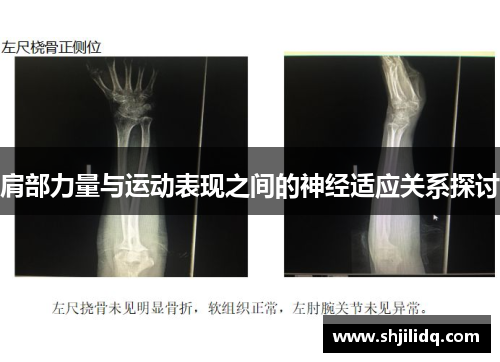 肩部力量与运动表现之间的神经适应关系探讨